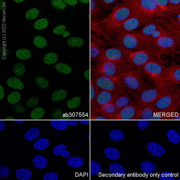Immunocytochemistry/ Immunofluorescence - Anti-Swd2 antibody [EPR27034-63] - BSA and Azide free (AB307555)