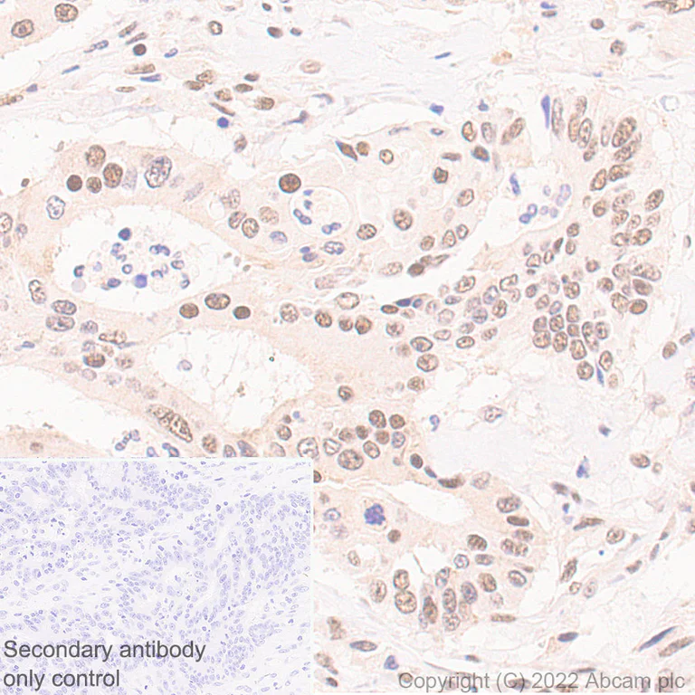 Immunohistochemistry (Formalin/PFA-fixed paraffin-embedded sections) - Anti-Swd2 antibody [EPR27034-63] - BSA and Azide free (AB307555)