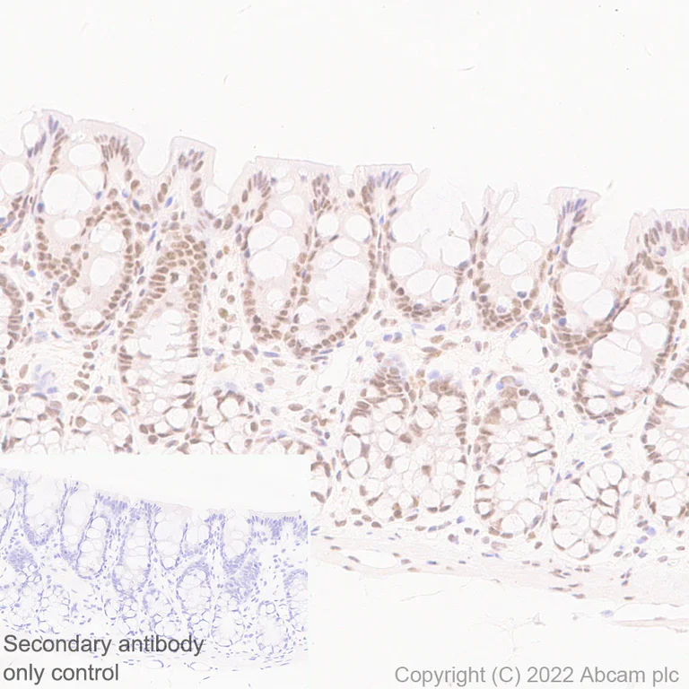 Immunohistochemistry (Formalin/PFA-fixed paraffin-embedded sections) - Anti-Swd2 antibody [EPR27034-63] - BSA and Azide free (AB307555)