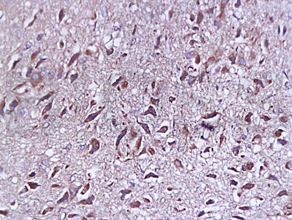 Immunohistochemistry (Formalin/PFA-fixed paraffin-embedded sections) - Anti-SYAP1 antibody (AB203045)