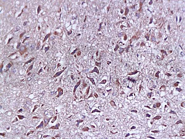 Immunohistochemistry (Formalin/PFA-fixed paraffin-embedded sections) - Anti-SYAP1 antibody (AB203045)
