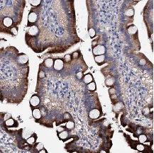 Immunohistochemistry (Formalin/PFA-fixed paraffin-embedded sections) - Anti-SYCE1 antibody (AB122634)