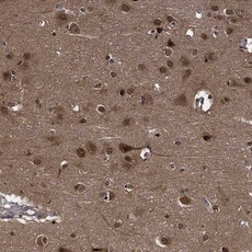 Immunohistochemistry (Formalin/PFA-fixed paraffin-embedded sections) - Anti-SYCP2L antibody (AB122224), expandable thumbnail