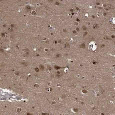 Immunohistochemistry (Formalin/PFA-fixed paraffin-embedded sections) - Anti-SYCP2L antibody (AB122224)