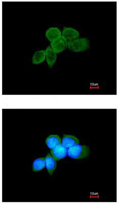 Immunocytochemistry/ Immunofluorescence - Anti-Syk antibody (AB155187)