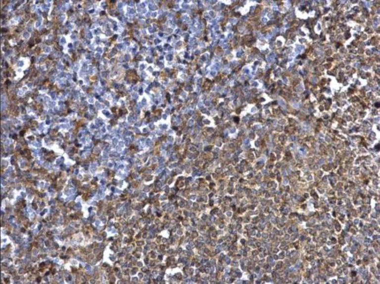 Immunohistochemistry (Formalin/PFA-fixed paraffin-embedded sections) - Anti-Syk antibody (AB155187)