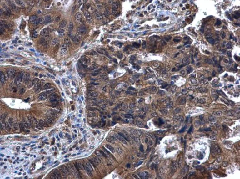 Immunohistochemistry (Formalin/PFA-fixed paraffin-embedded sections) - Anti-Syk antibody (AB155187)