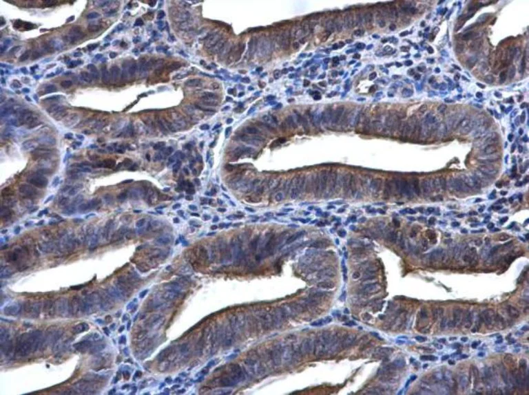 Immunohistochemistry (Formalin/PFA-fixed paraffin-embedded sections) - Anti-Syk antibody (AB155187)