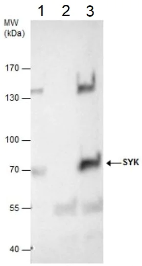 Immunoprecipitation - Anti-Syk antibody (AB155187)