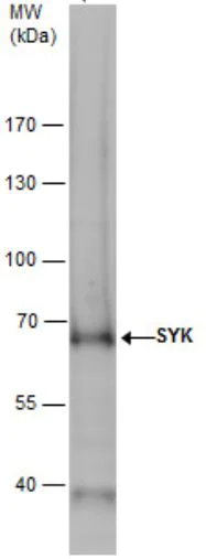 Western blot - Anti-Syk antibody (AB155187)