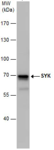 Western blot - Anti-Syk antibody (AB155187)