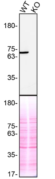 Western blot - Anti-Syk antibody [EP573Y] (AB40781)