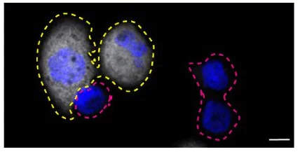 Immunocytochemistry/ Immunofluorescence - Anti-Syk antibody [EP573Y] - BSA and Azide free (AB190176)
