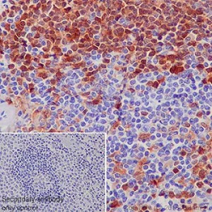 Immunohistochemistry (Formalin/PFA-fixed paraffin-embedded sections) - Anti-Syk antibody [EP573Y] - BSA and Azide free (AB190176)