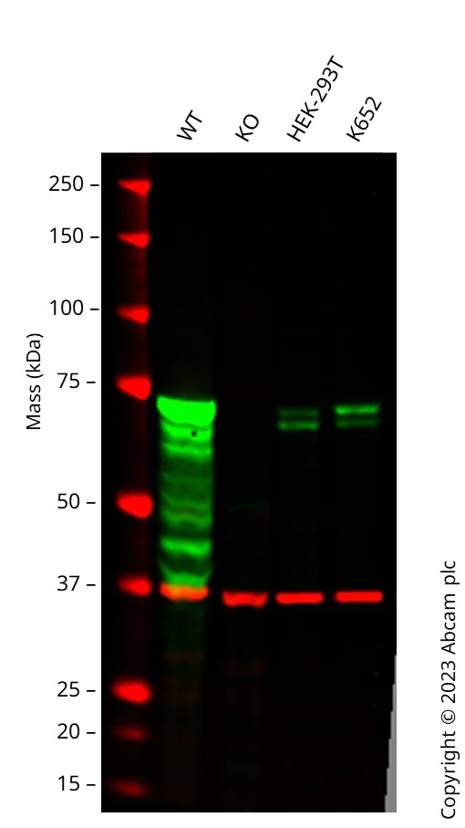 Western blot - Anti-Syk antibody [EP573Y] - BSA and Azide free (AB190176)