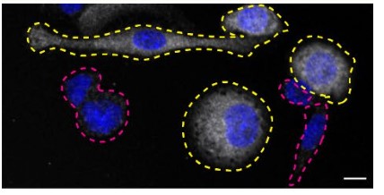 Immunocytochemistry/ Immunofluorescence - Anti-Syk antibody [EPR19414-176] - BSA and Azide free (Capture) (AB244701), expandable thumbnail