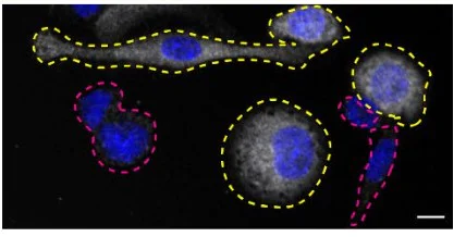Immunocytochemistry/ Immunofluorescence - Anti-Syk antibody [EPR19414-176] - BSA and Azide free (Capture) (AB244701)