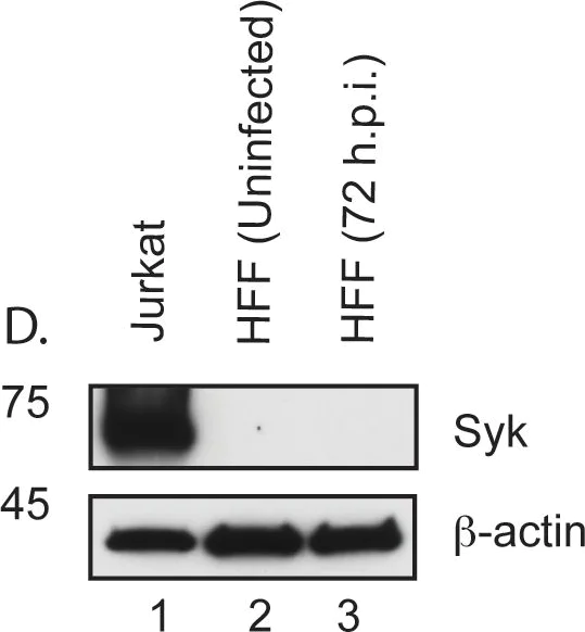 Western blot - Anti-Syk antibody [SYK-01] (AB3993)