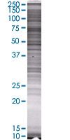SDS-PAGE - Syk overexpression 293T lysate (whole cell) (AB94330), expandable thumbnail