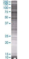 SDS-PAGE - Syk overexpression 293T lysate (whole cell) (AB94330)