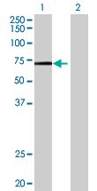 Western blot - Syk overexpression 293T lysate (whole cell) (AB94330), expandable thumbnail
