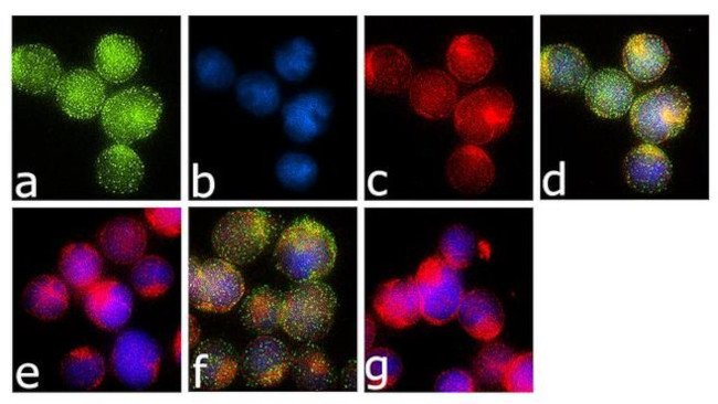 Immunocytochemistry/ Immunofluorescence - Anti-Syk (phospho T317 + T323) Antibody [RP23040187] (AB313476)