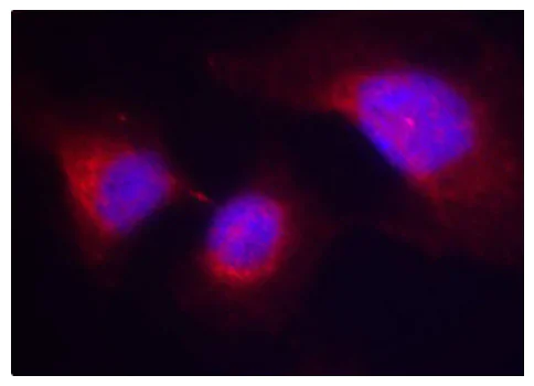 Immunocytochemistry/ Immunofluorescence - Anti-Syk (phospho Y323) antibody (AB194852)