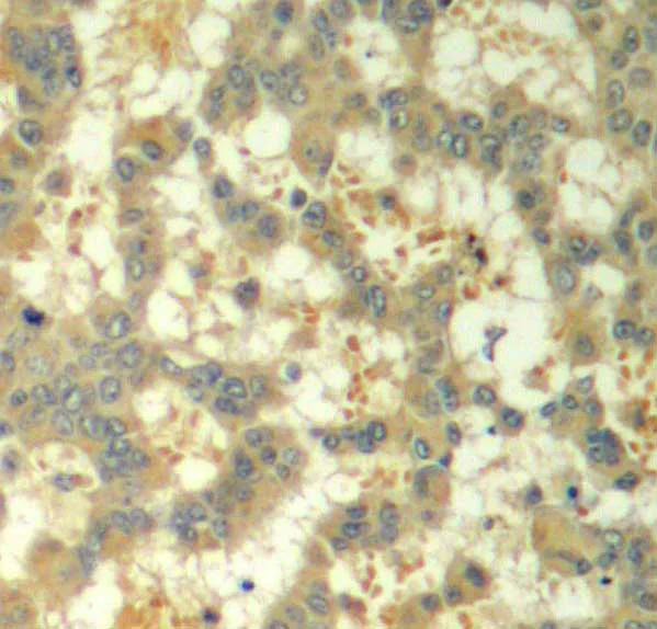 Immunohistochemistry (Formalin/PFA-fixed paraffin-embedded sections) - Anti-Syk (phospho Y323) antibody (AB194852)