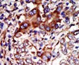 Immunohistochemistry (Formalin/PFA-fixed paraffin-embedded sections) - Anti-Syk (phospho Y323) antibody (AB63515)