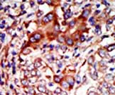 Immunohistochemistry (Formalin/PFA-fixed paraffin-embedded sections) - Anti-Syk (phospho Y323) antibody (AB63515)
