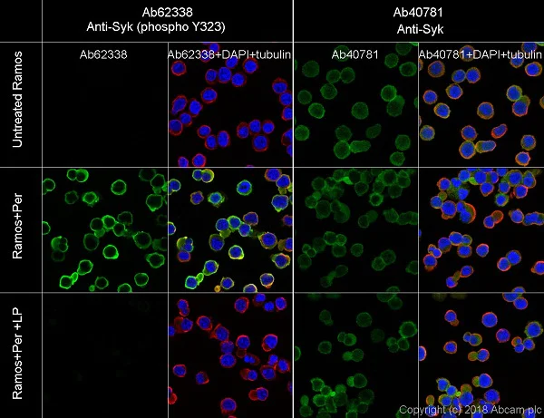 Immunocytochemistry/ Immunofluorescence - Anti-Syk (phospho Y323) antibody [EP573-4] - BSA and Azide free (AB169865)