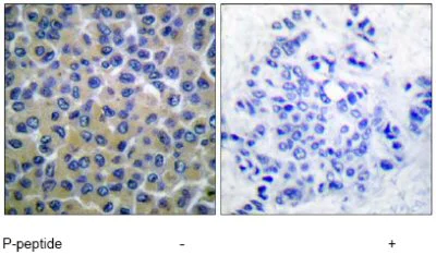 Immunohistochemistry (Formalin/PFA-fixed paraffin-embedded sections) - Anti-Syk (phospho Y348) antibody (AB52212)