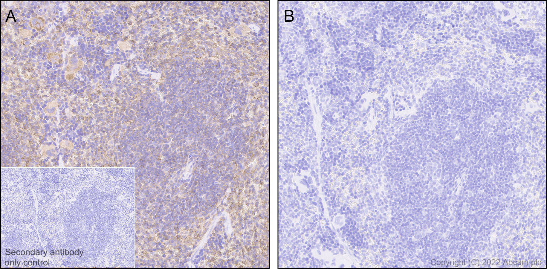 Immunohistochemistry (Formalin/PFA-fixed paraffin-embedded sections) - Anti-Syk (phospho Y352) +ZAP70 (phospho Y319) antibody [EPR26232-39] (ab300398), expandable thumbnail