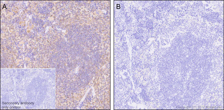 Immunohistochemistry (Formalin/PFA-fixed paraffin-embedded sections) - Anti-Syk (phospho Y352) +ZAP70 (phospho Y319) antibody [EPR26232-39] (AB300398)