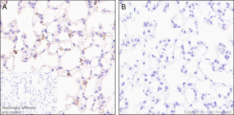 Immunohistochemistry (Formalin/PFA-fixed paraffin-embedded sections) - Anti-Syk (phospho Y352) +ZAP70 (phospho Y319) antibody [EPR26232-39] (AB300398)