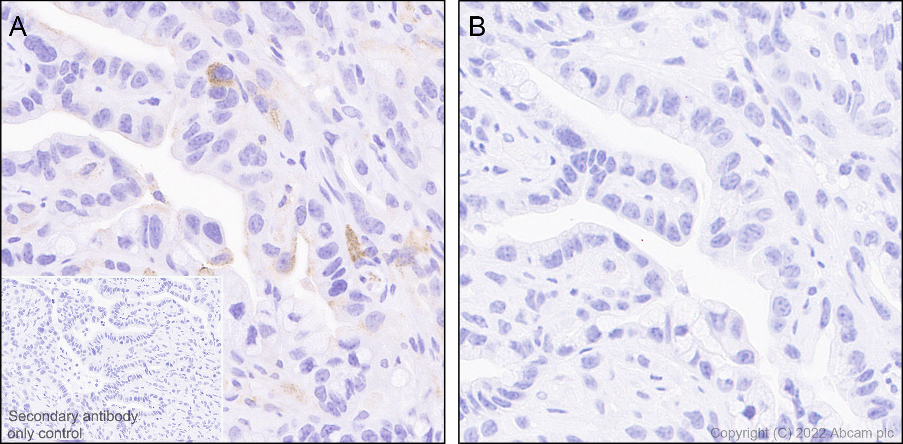 Immunohistochemistry (Formalin/PFA-fixed paraffin-embedded sections) - Anti-Syk (phospho Y352) +ZAP70 (phospho Y319) antibody [EPR26232-39] (AB300398), expandable thumbnail