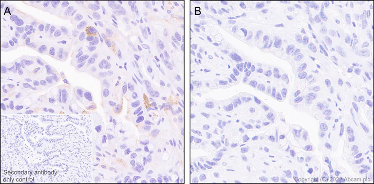 Immunohistochemistry (Formalin/PFA-fixed paraffin-embedded sections) - Anti-Syk (phospho Y352) +ZAP70 (phospho Y319) antibody [EPR26232-39] (AB300398)