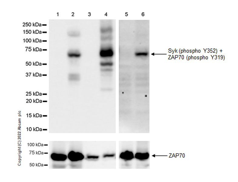 Western blot - Anti-Syk (phospho Y352) +ZAP70 (phospho Y319) antibody [EPR26232-39] (AB300398)