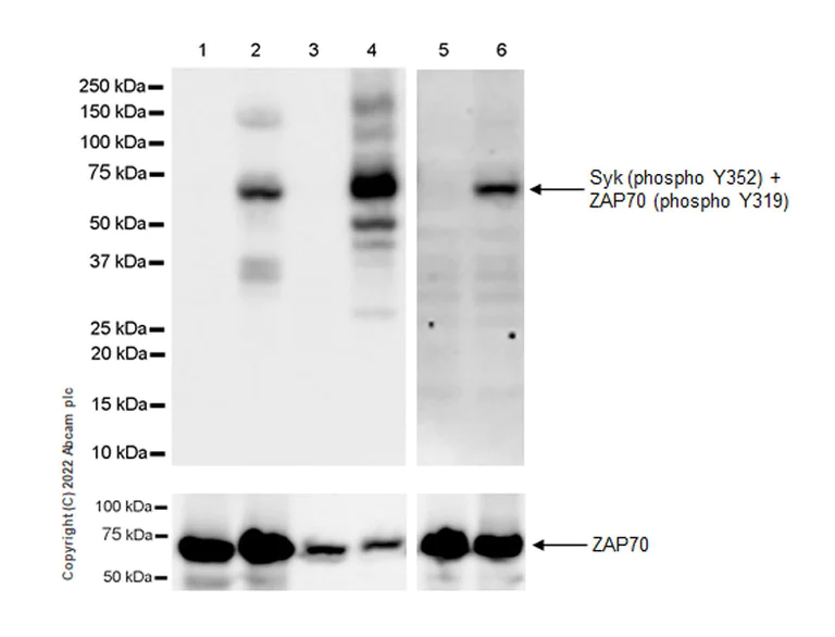 Western blot - Anti-Syk (phospho Y352) +ZAP70 (phospho Y319) antibody [EPR26232-39] - BSA and Azide free (AB300410)