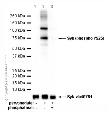 Western blot - Anti-Syk (phospho Y525) antibody [EP575(2)Y] - BSA and Azide free (AB247353)