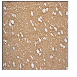 Immunohistochemistry (Formalin/PFA-fixed paraffin-embedded sections) - Anti-SYN2 antibody [EPR3277] (AB76494), expandable thumbnail