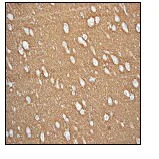 Immunohistochemistry (Formalin/PFA-fixed paraffin-embedded sections) - Anti-SYN2 antibody [EPR3277] (AB76494)