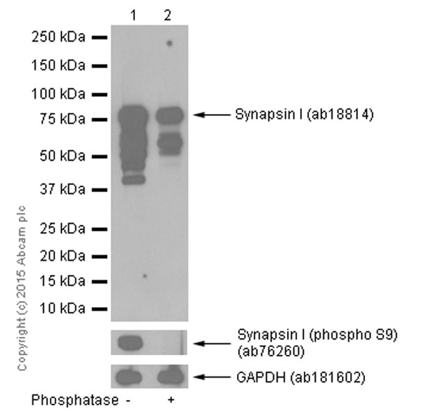 Western blot - Anti-Synapsin I antibody (AB18814), expandable thumbnail