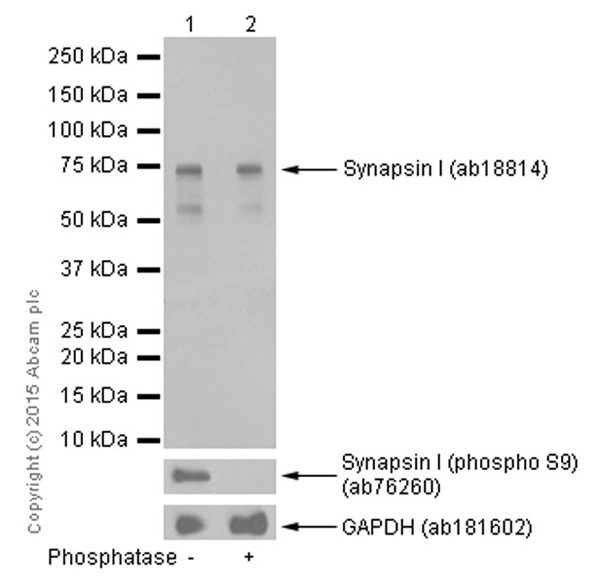 Western blot - Anti-Synapsin I antibody (AB18814), expandable thumbnail