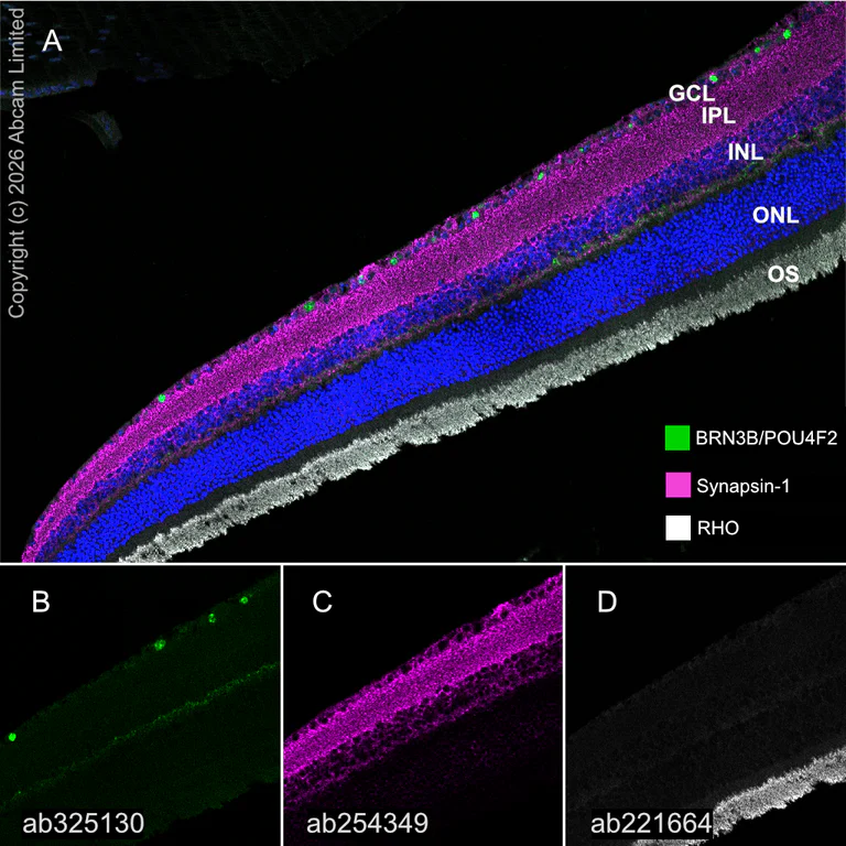 Multiplex immunohistochemistry - Anti-Synapsin I antibody [EPR23531-50] - Synaptic Marker (AB254349)