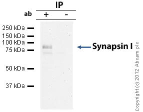 Immunoprecipitation - Anti-Synapsin I antibody - Synaptic Marker (AB64581)