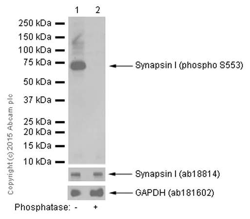 Western blot - Anti-Synapsin I (phospho S553) antibody [E377] (AB32532)