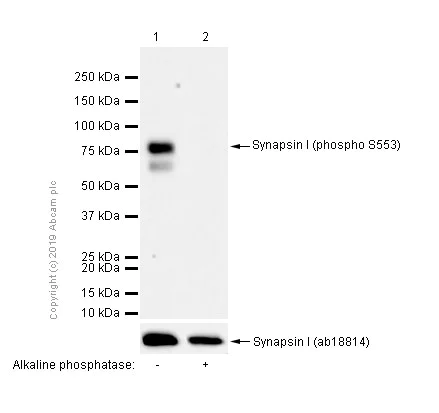 Western blot - Anti-Synapsin I (phospho S553) antibody [E377] (AB32532)