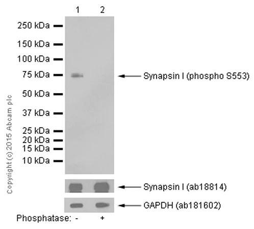 Western blot - Anti-Synapsin I (phospho S553) antibody [E377] (AB32532)
