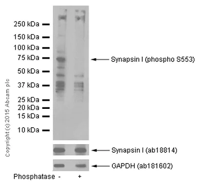 Western blot - Anti-Synapsin I (phospho S553) antibody [E377] (AB32532)